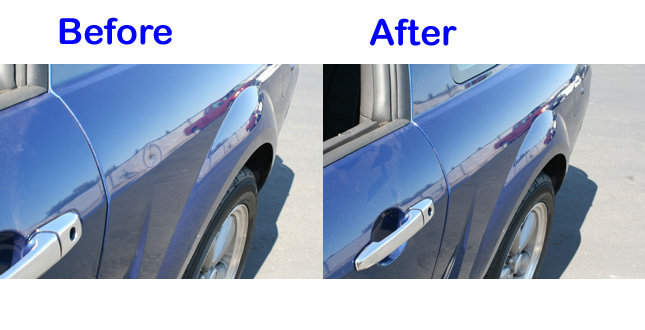 dent before and after